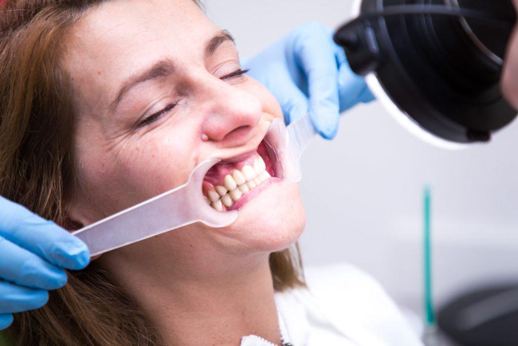 Uradnja zubne proteze u poliklinici ARENA
