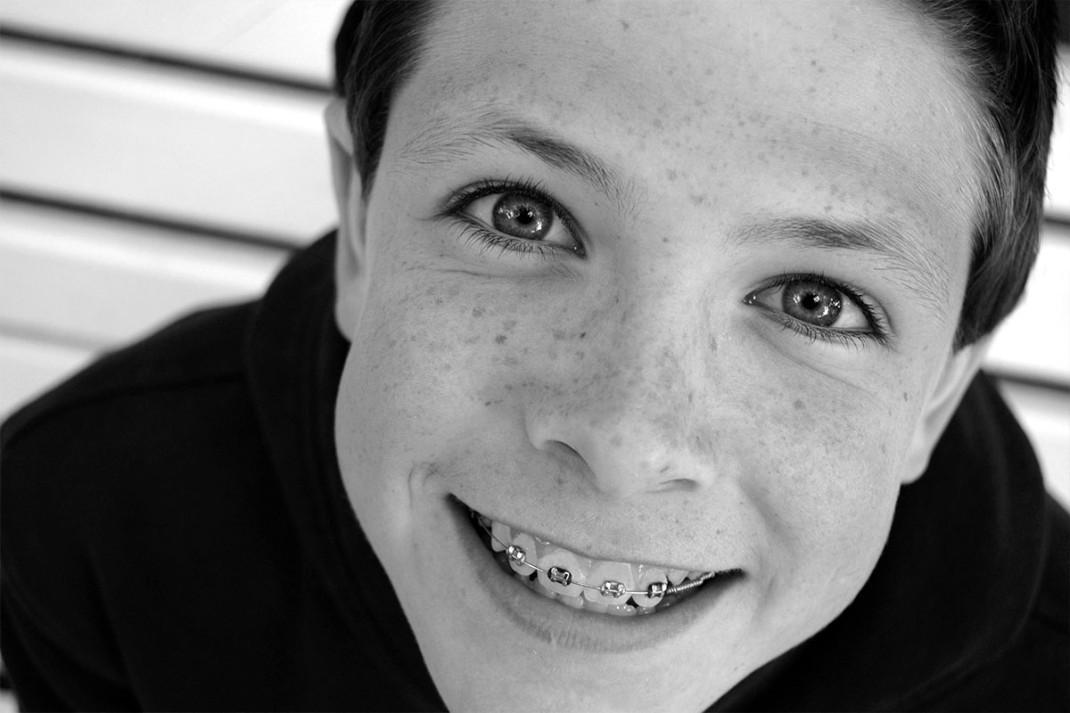 Dijete s fiksnim ortodontskim apartatićem.