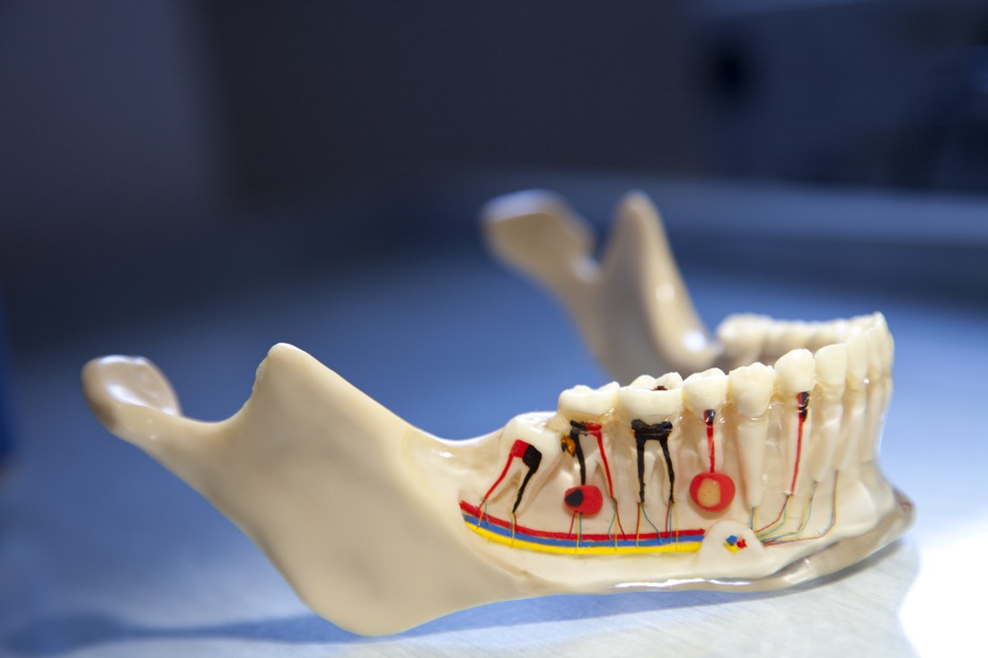 Poprečni prikaz donje čeljusti s odrađenom endodoncijom na zubima